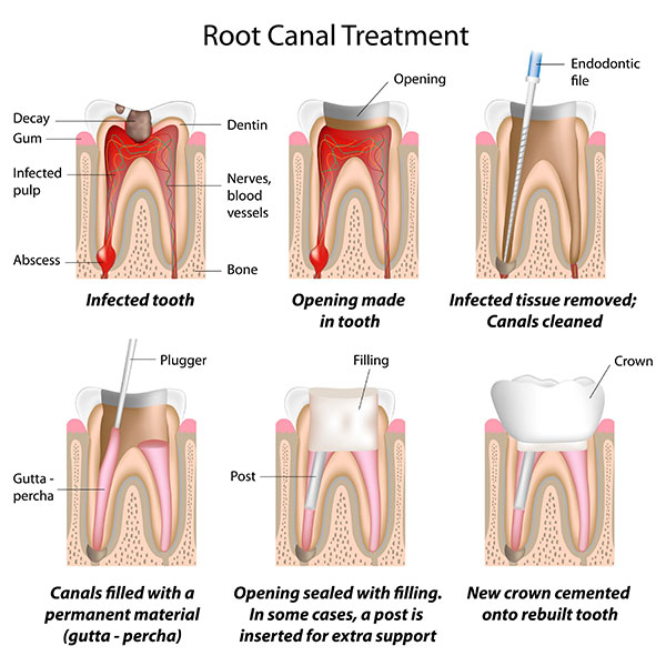 rct-structure
